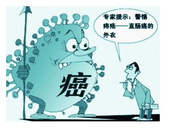 广州东大医院：慢性结肠炎是否会诱发癌变