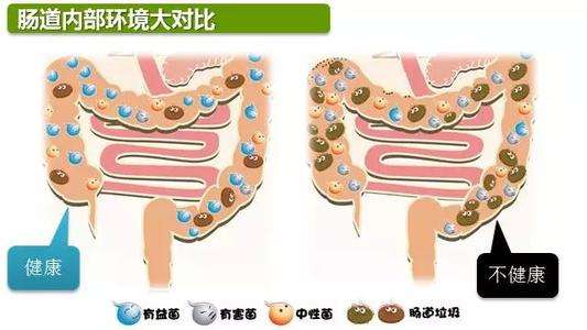 十二指肠憩室并发症状 广州东大医院正规吗